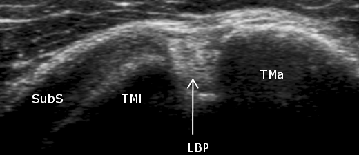 echografie opleiding